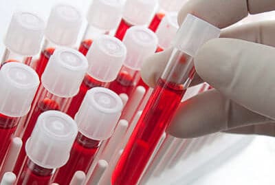 Blood tests in DUI cases